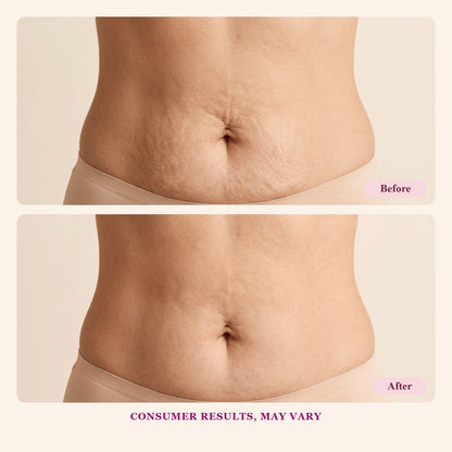 Fermeskin before and after illustrative visualization